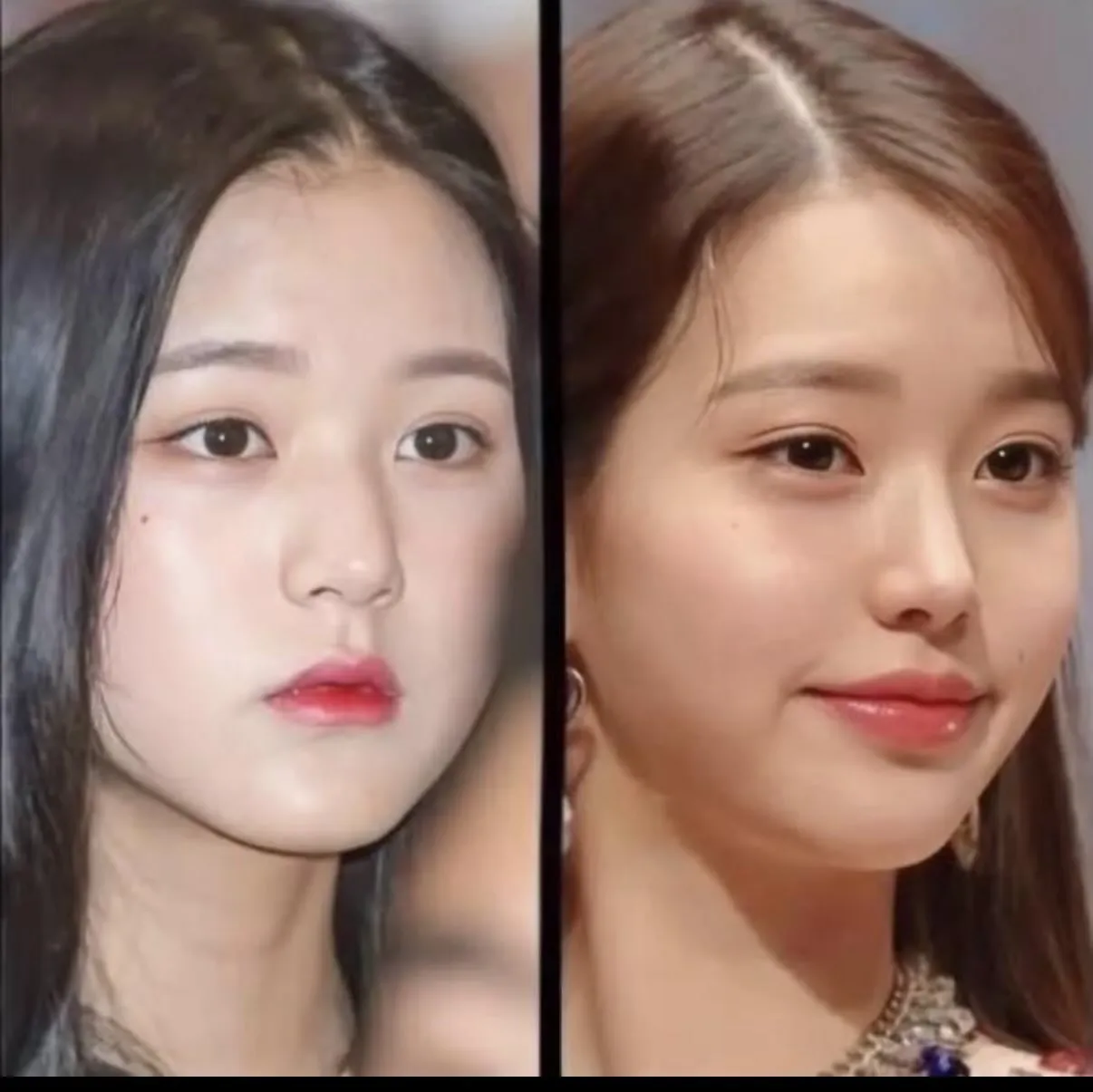 워뇨 성형 많이했다 하지만