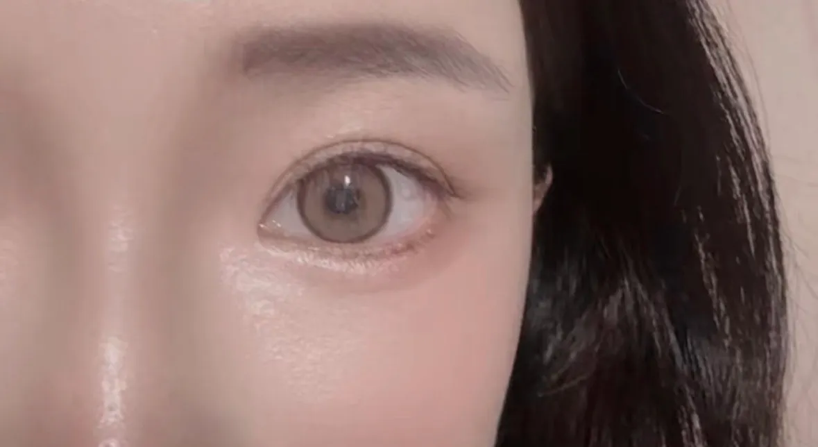 쌍수 전후2