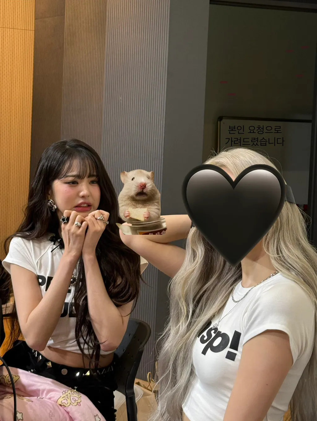 원영이 하관 입술이