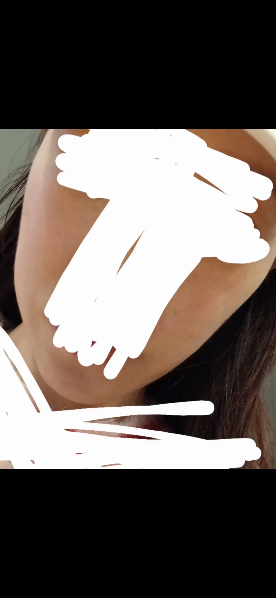 턱 존나 짧은데 댓글