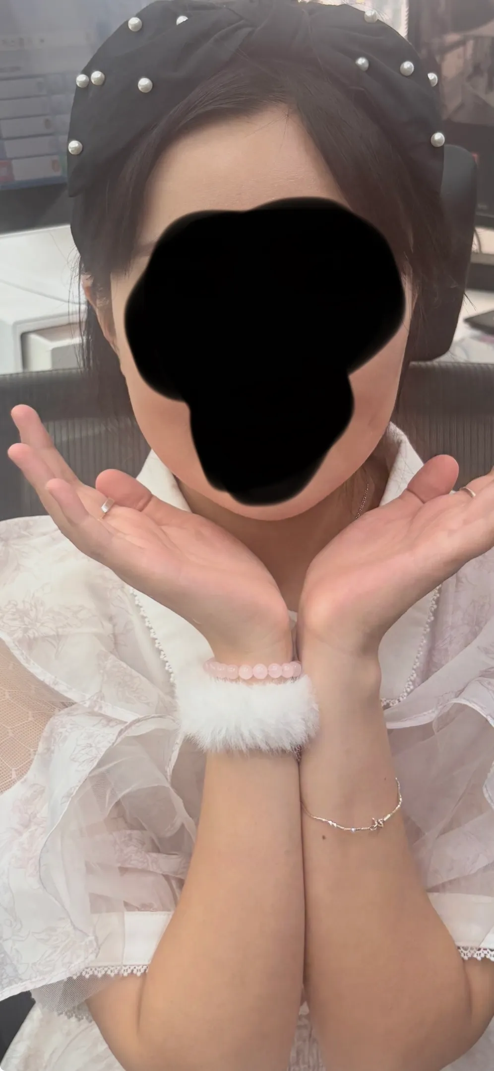 얼굴형 이런데 윤곽 양악 봐줄사람