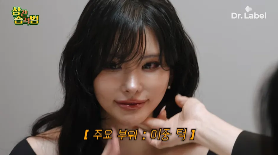 진짜 나이들면 실리프팅 해야할까요?7