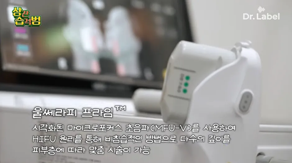 진짜 나이들면 실리프팅 해야할까요?8