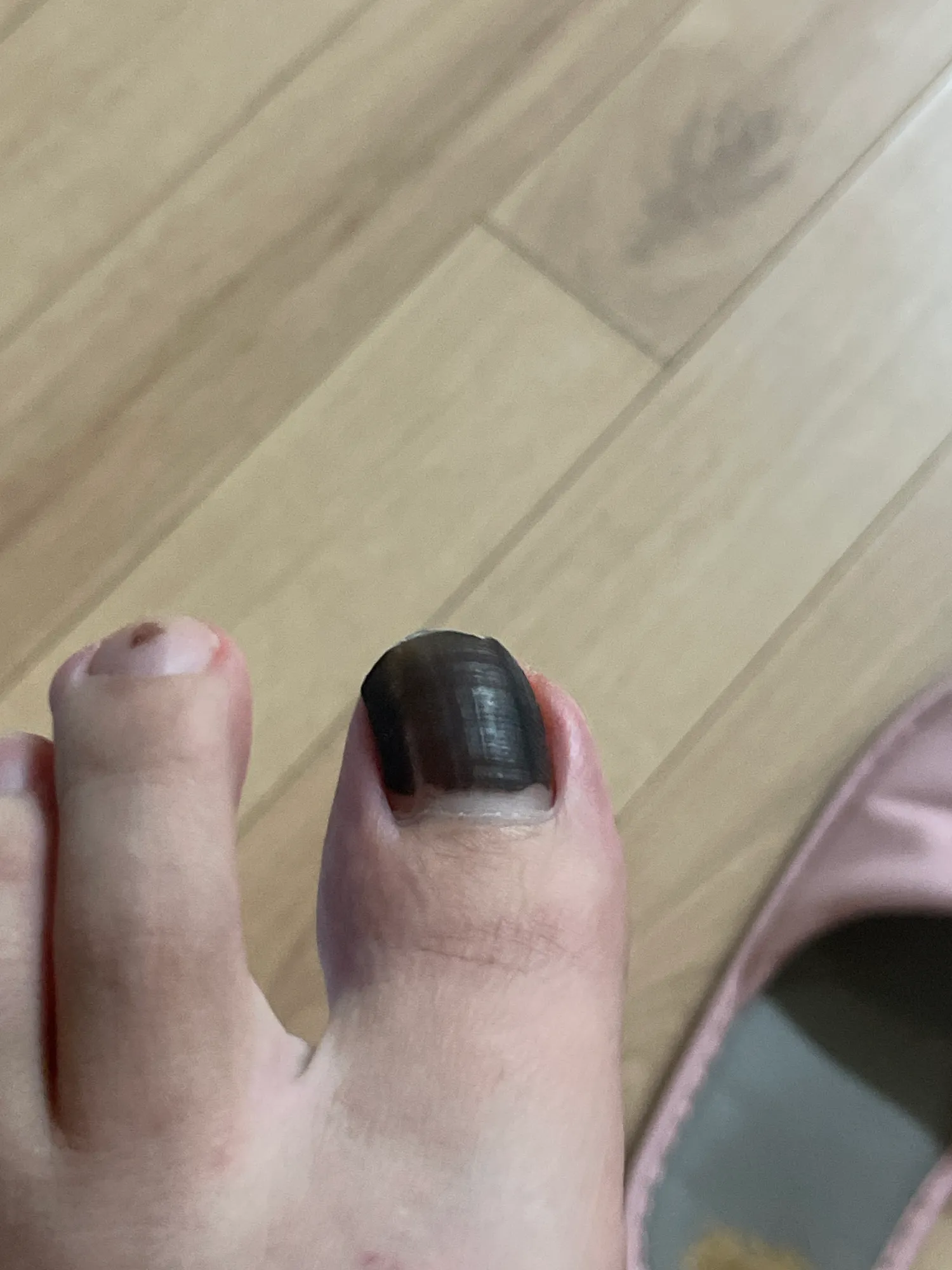 패디먼색할까요 댓글