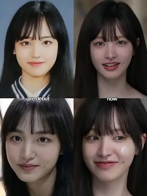 리즈 코 다시 했다고 말이많자나요 댓글