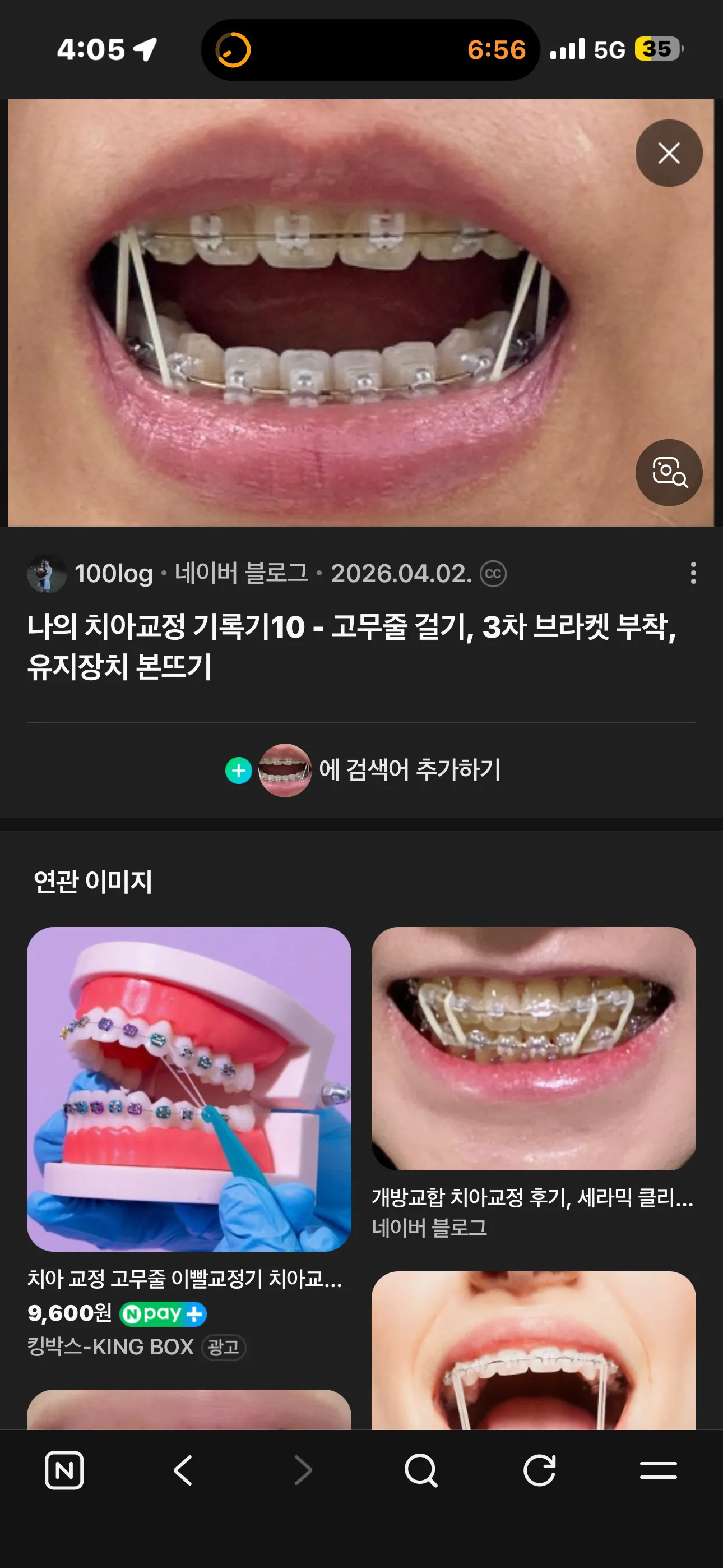 ㅎㅍ고무줄
