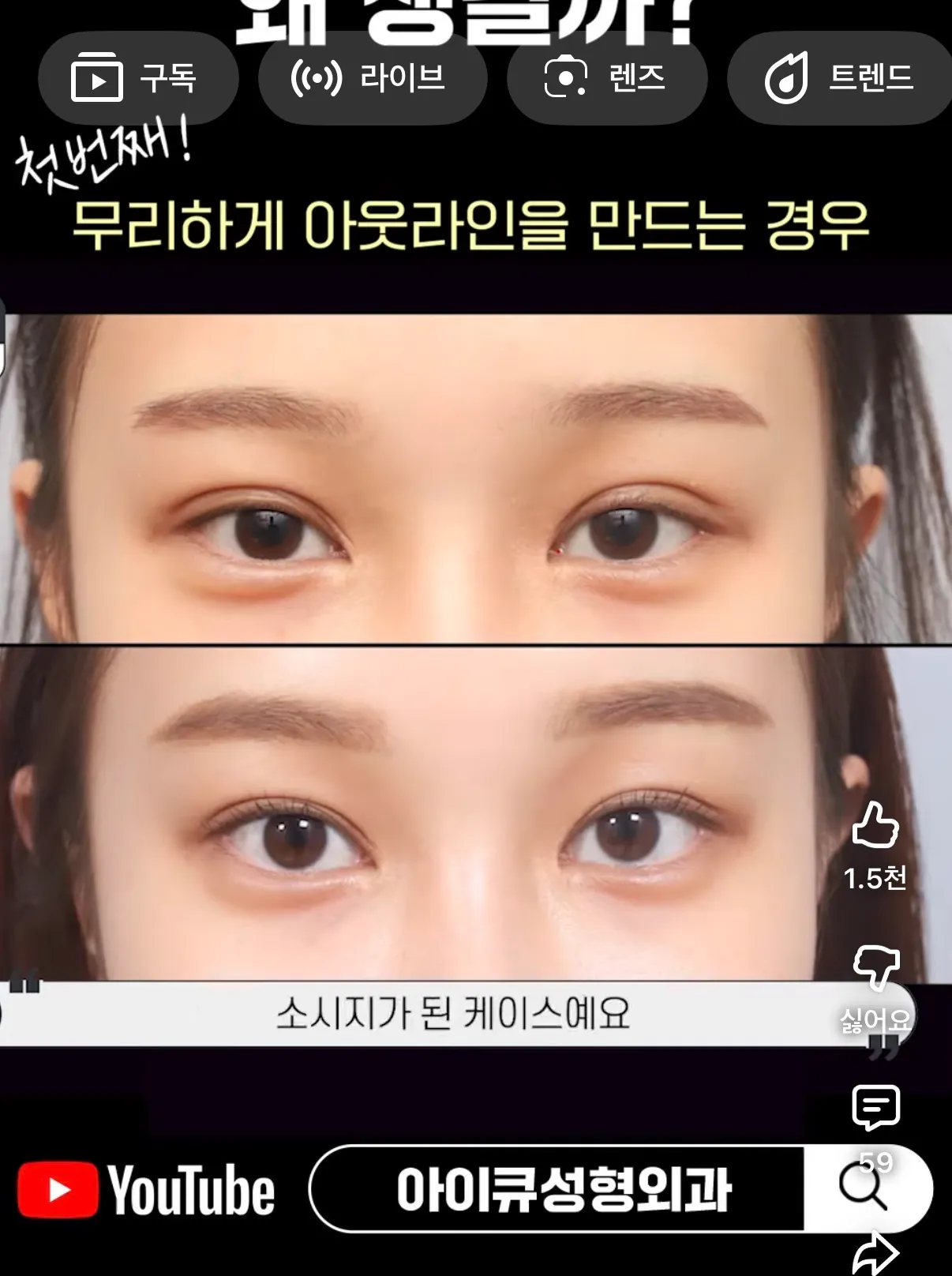 왜 소세지눈이 더