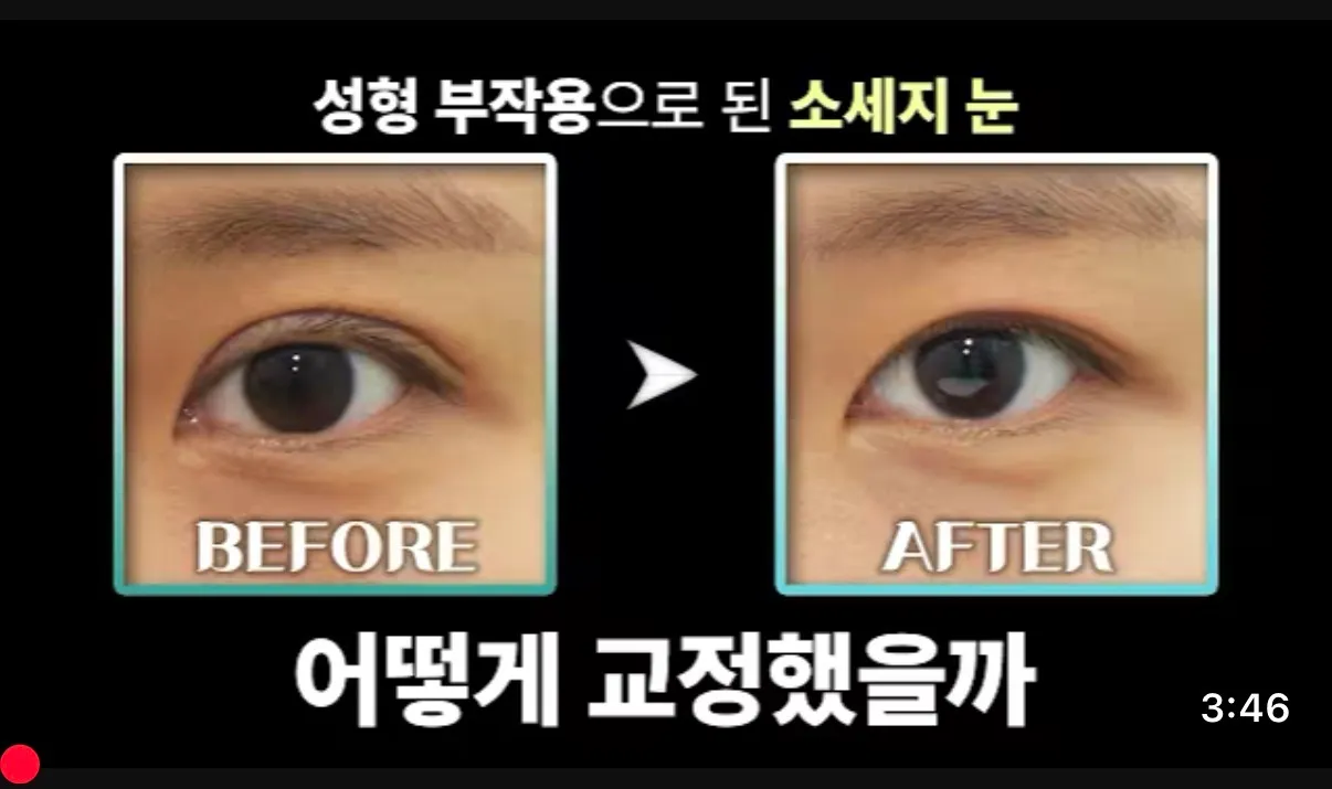 왜 소세지눈이 더2