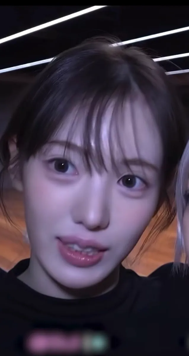 애교 그린걸까요 필러일까요?