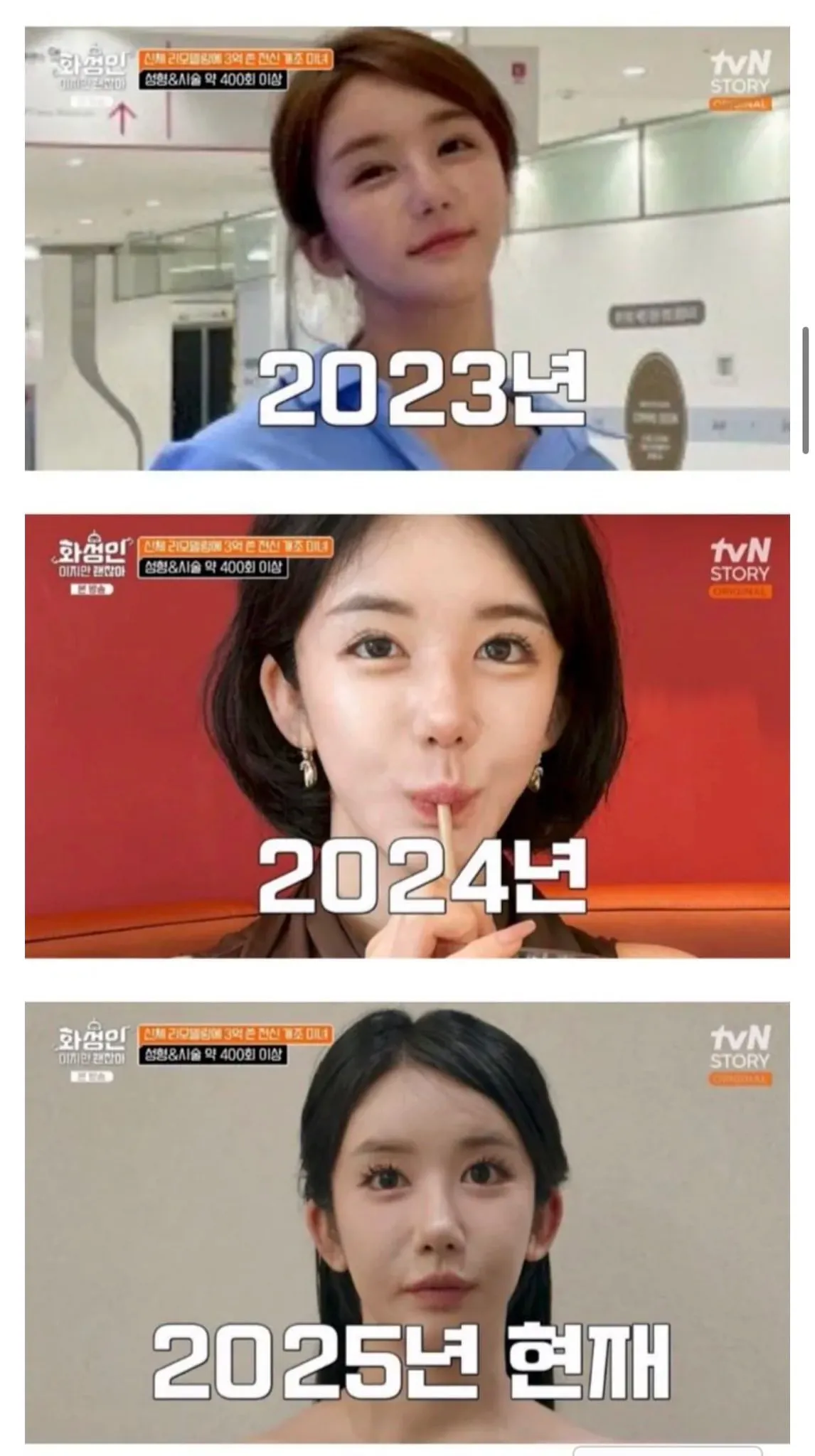 성형 400번해서 3억썻다는데 머가 바뀐거임