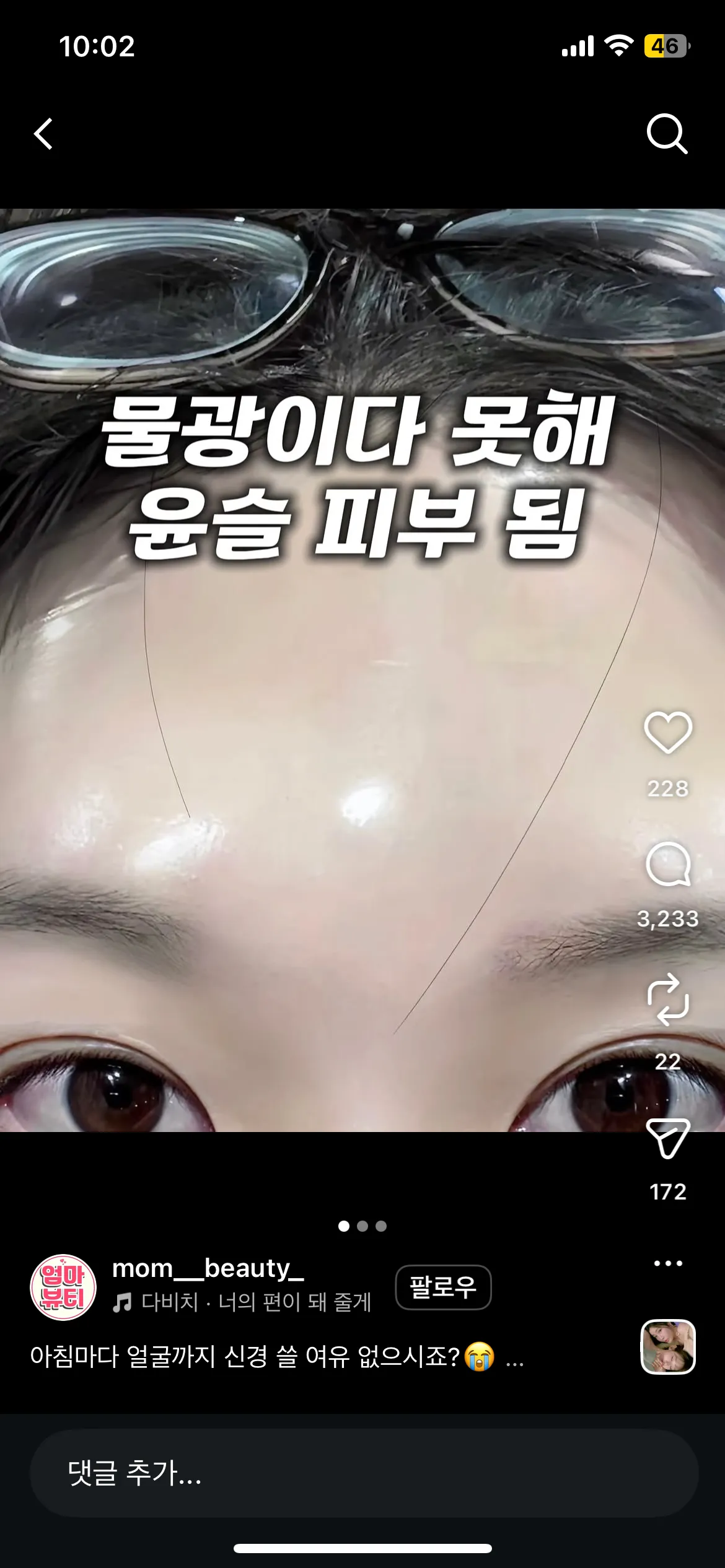 리쥬란 세번이나 맞앗는데 광 안생기는데