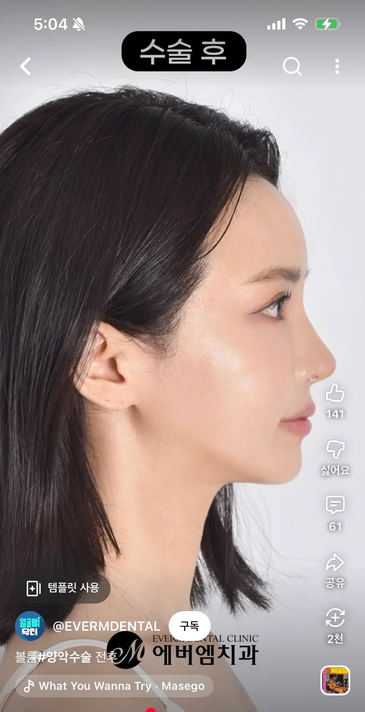 양악 케이스인지 아는법2