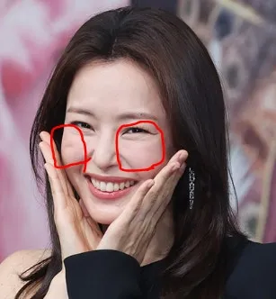 이거 주름 이름이 머예여..?