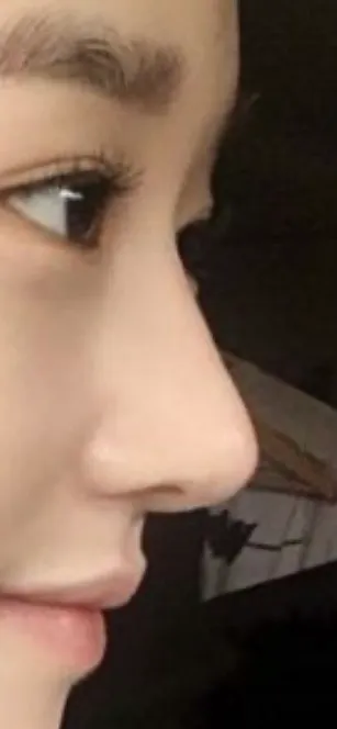 직반라인 코 언니들의 원픽은?2