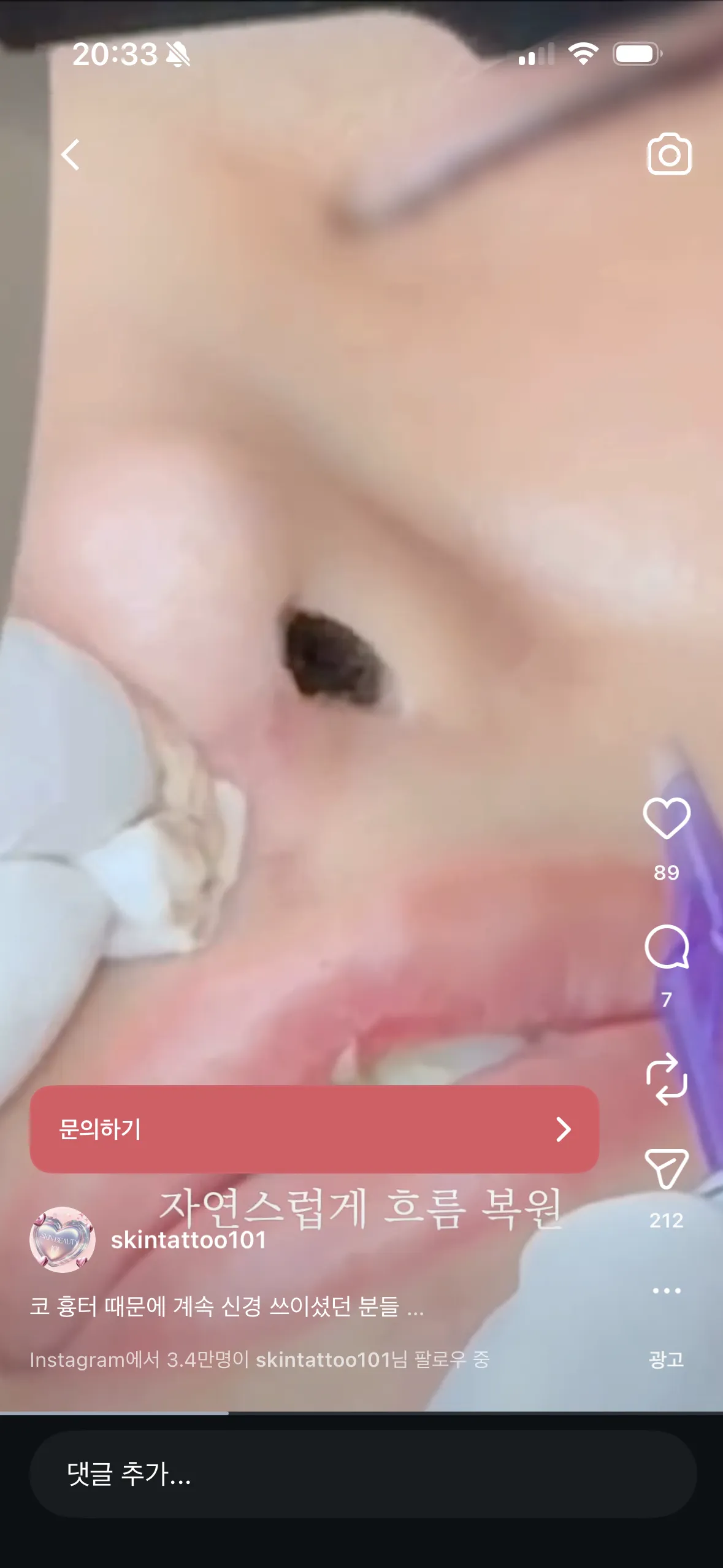 요새 코수술 흉터도 타투로 가리나 봐요