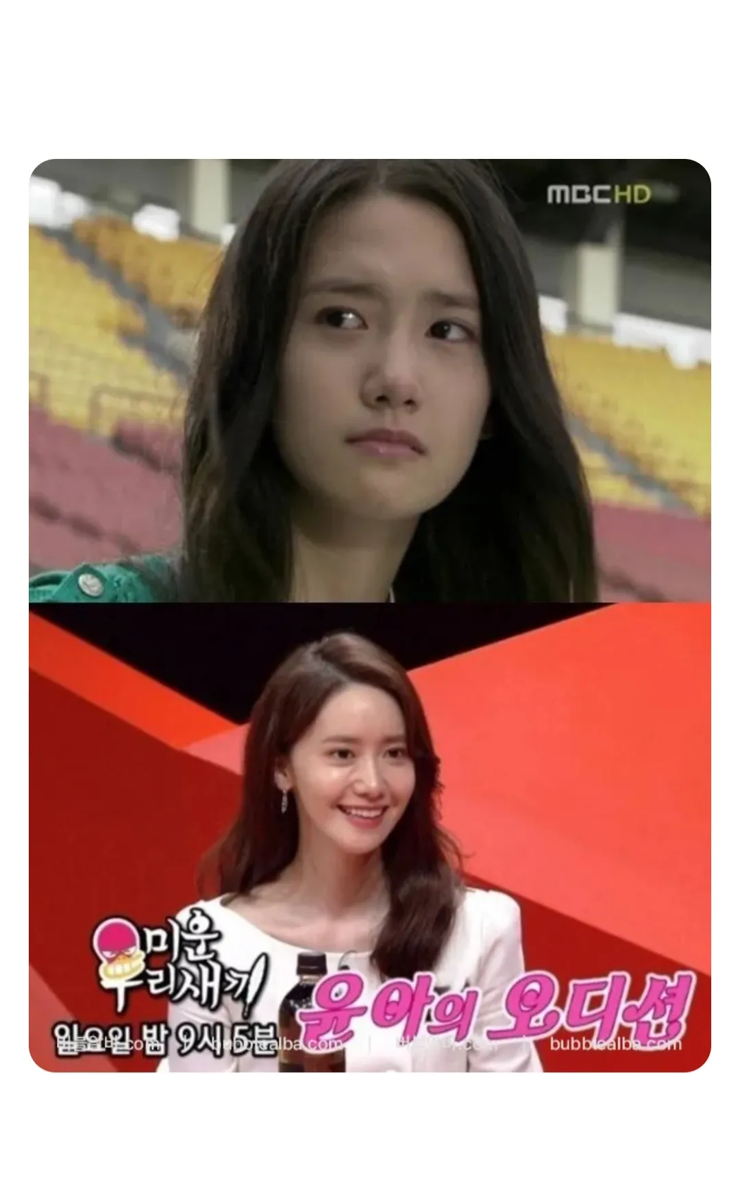 저 윤아 양악전 얼굴 같은데