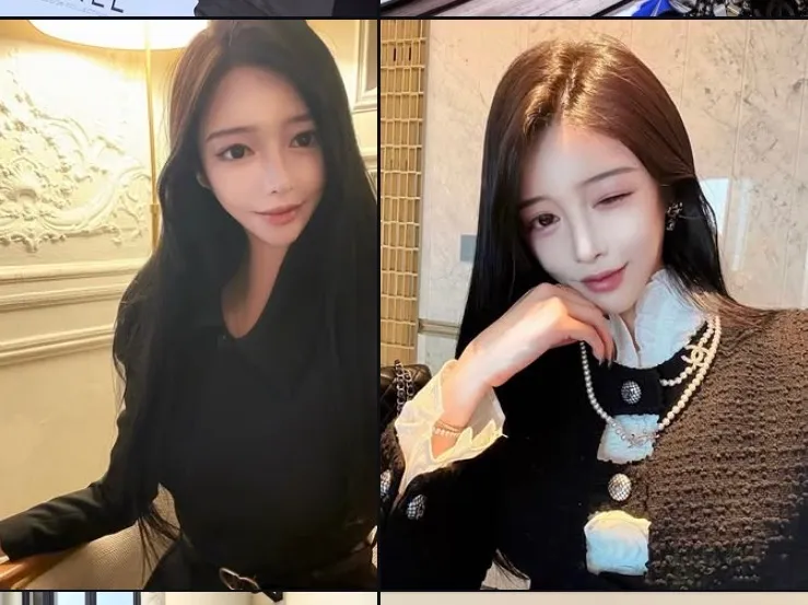 인스타 돋보기에 뜨길래 ..이런얼굴은 텐이에요 브압이에요?