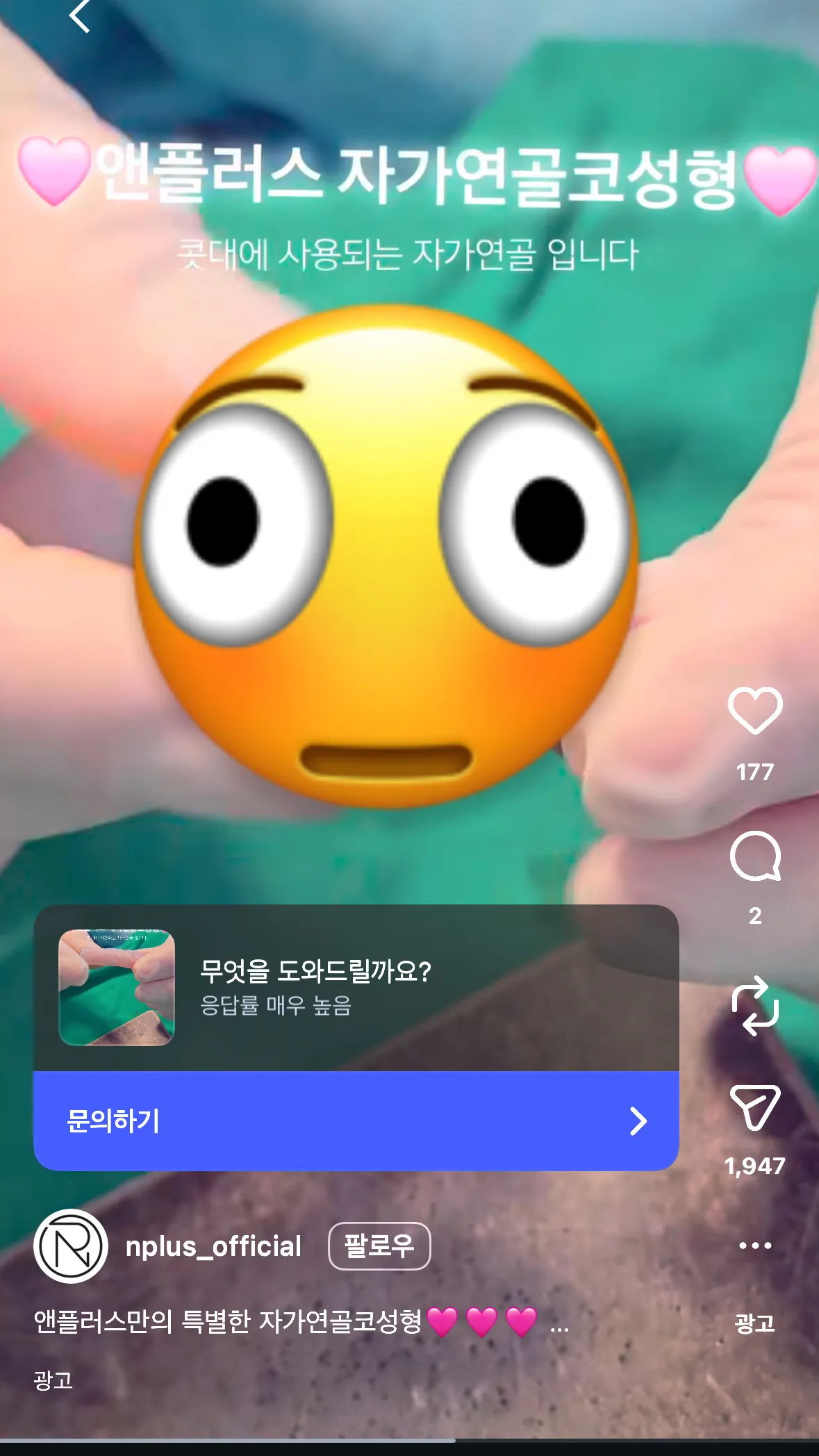 아니 끼발 성형외과 단체로 돌았나