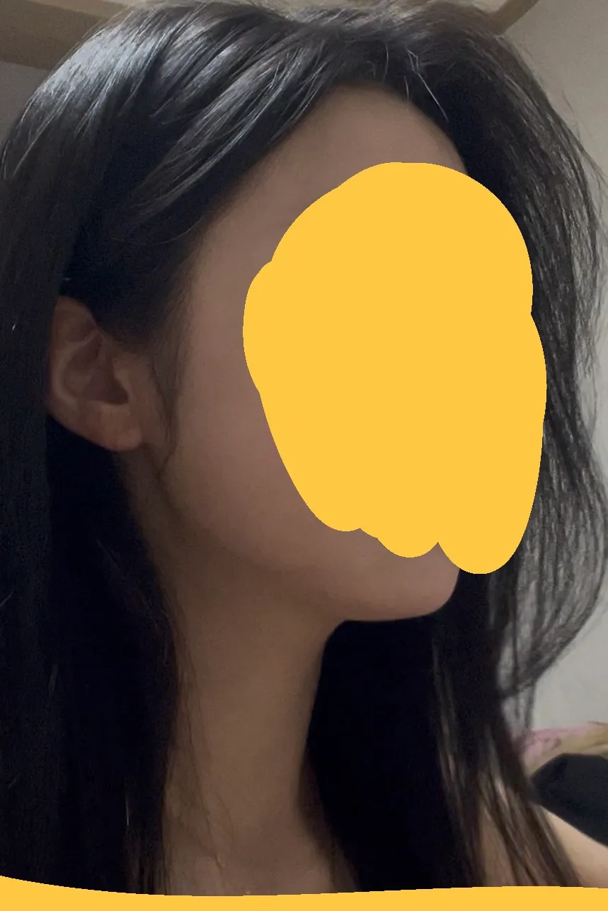 사각턱 치면 티날까요ㅜ?