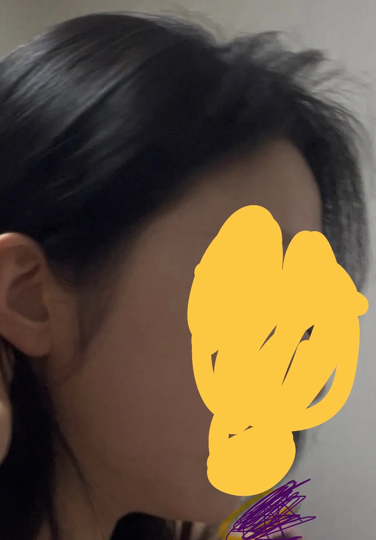 사각턱 치면 티날까요ㅜ?2