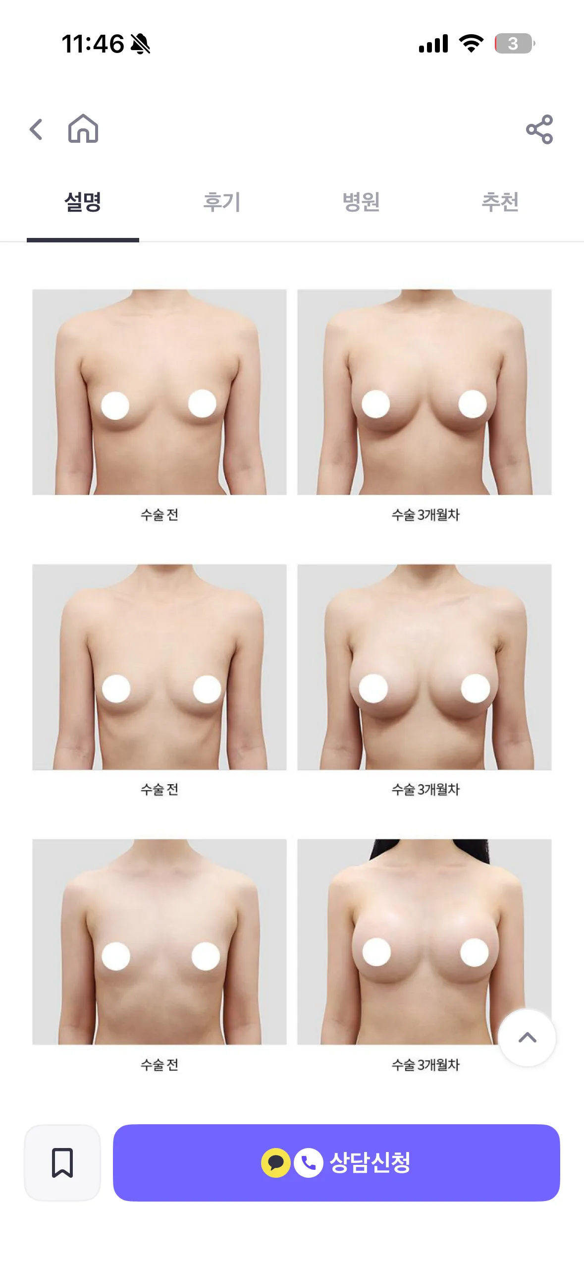 모티바vs멘토