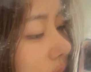 이런 코 라인은