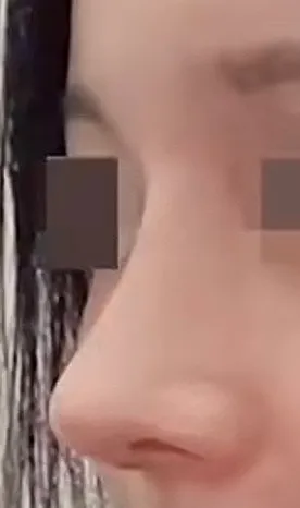 남자코 같아용?