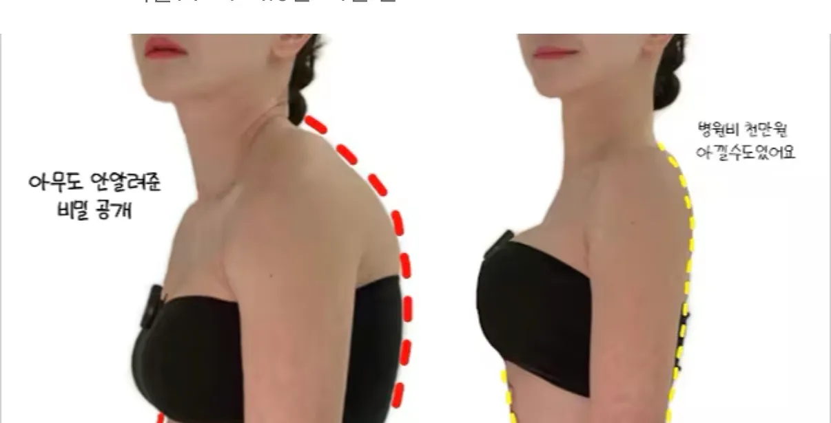 자세 전후 차이