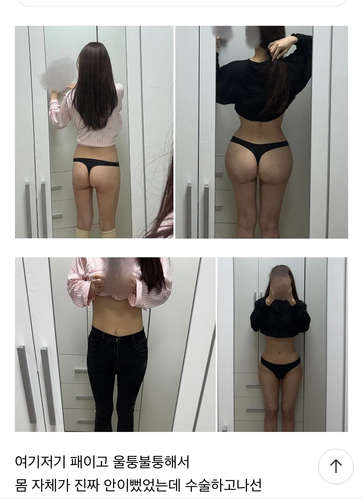 살빠지고나서 엉덩이