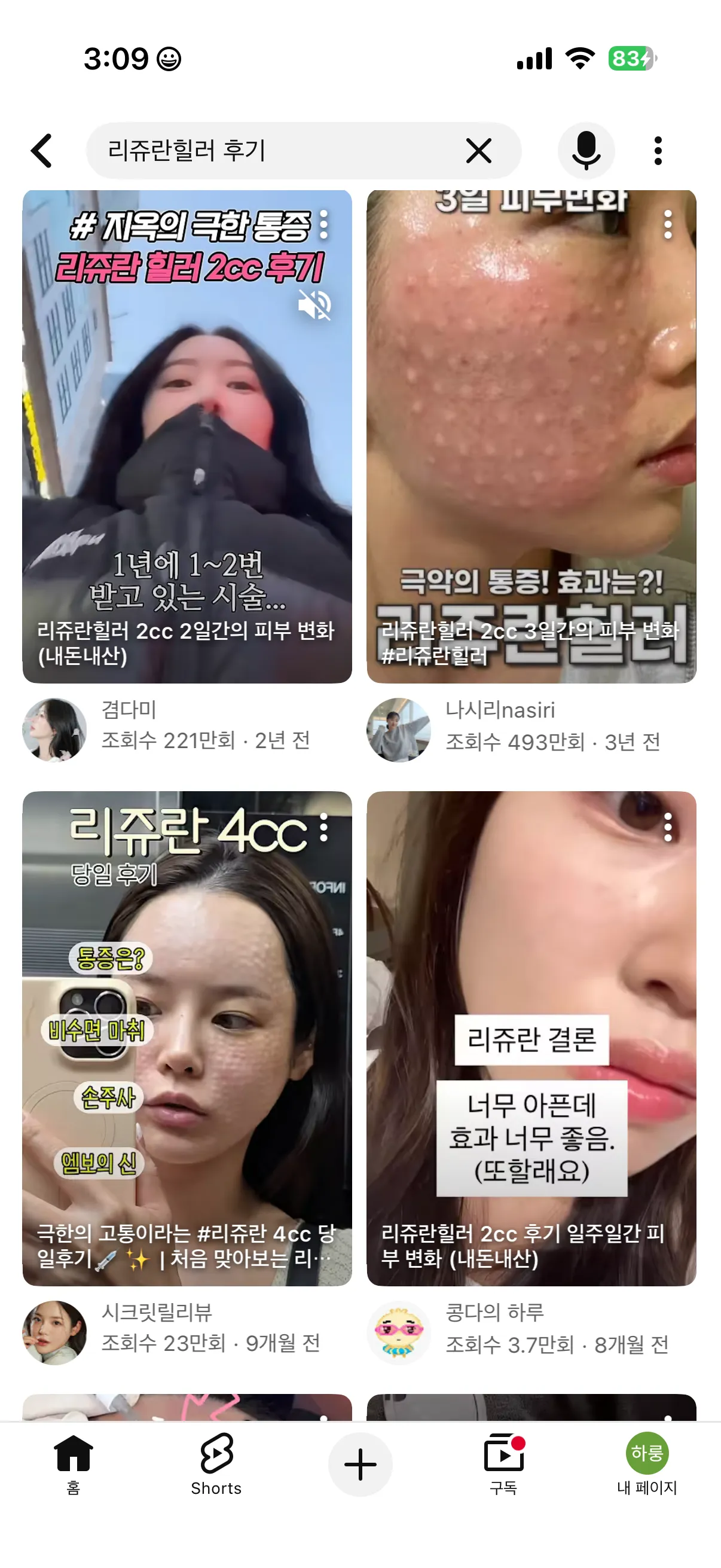 리쥬란/스킨보톡스