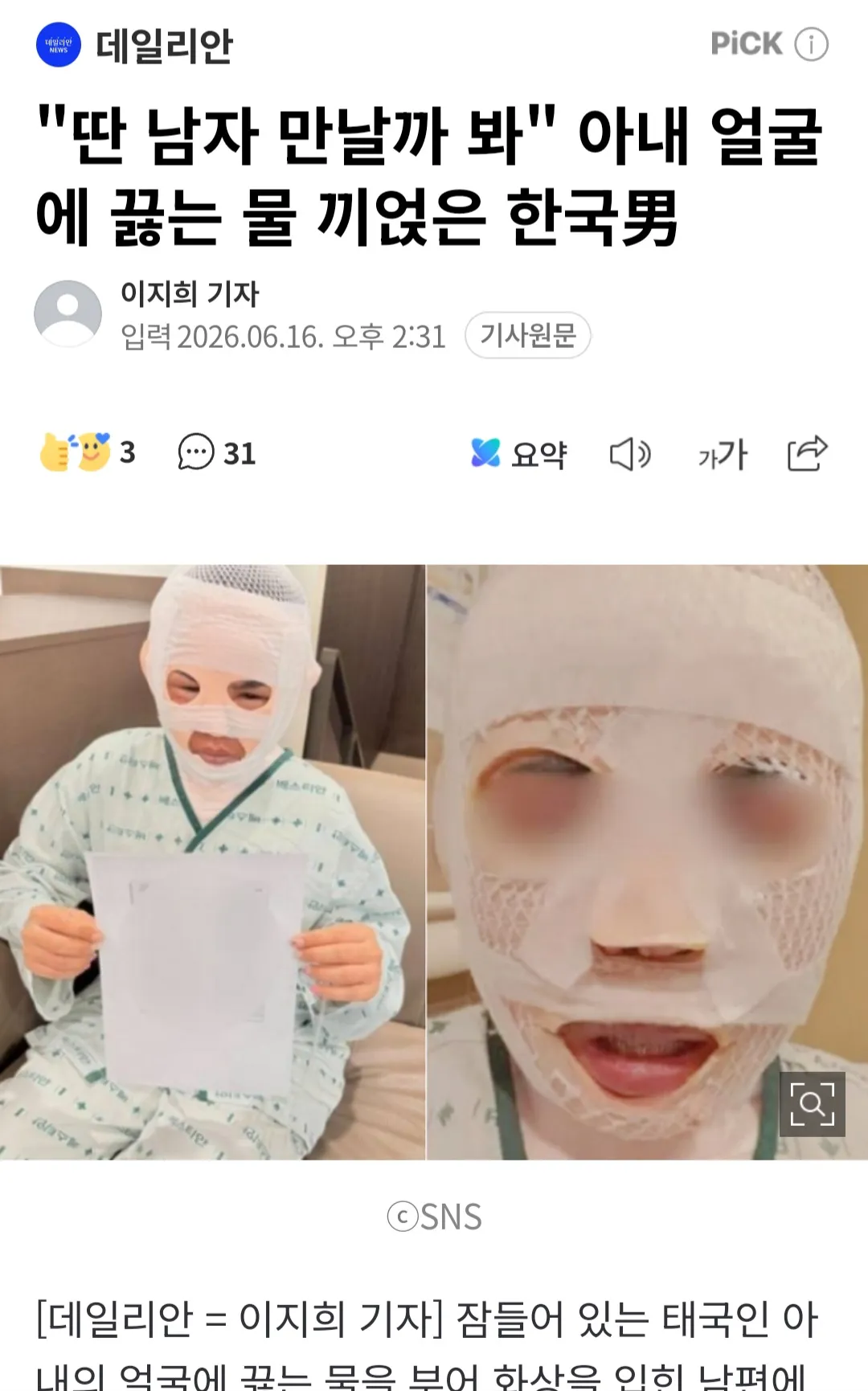 여자 바람필까봐 태국아내 잘때 뜨거운물 뿌린