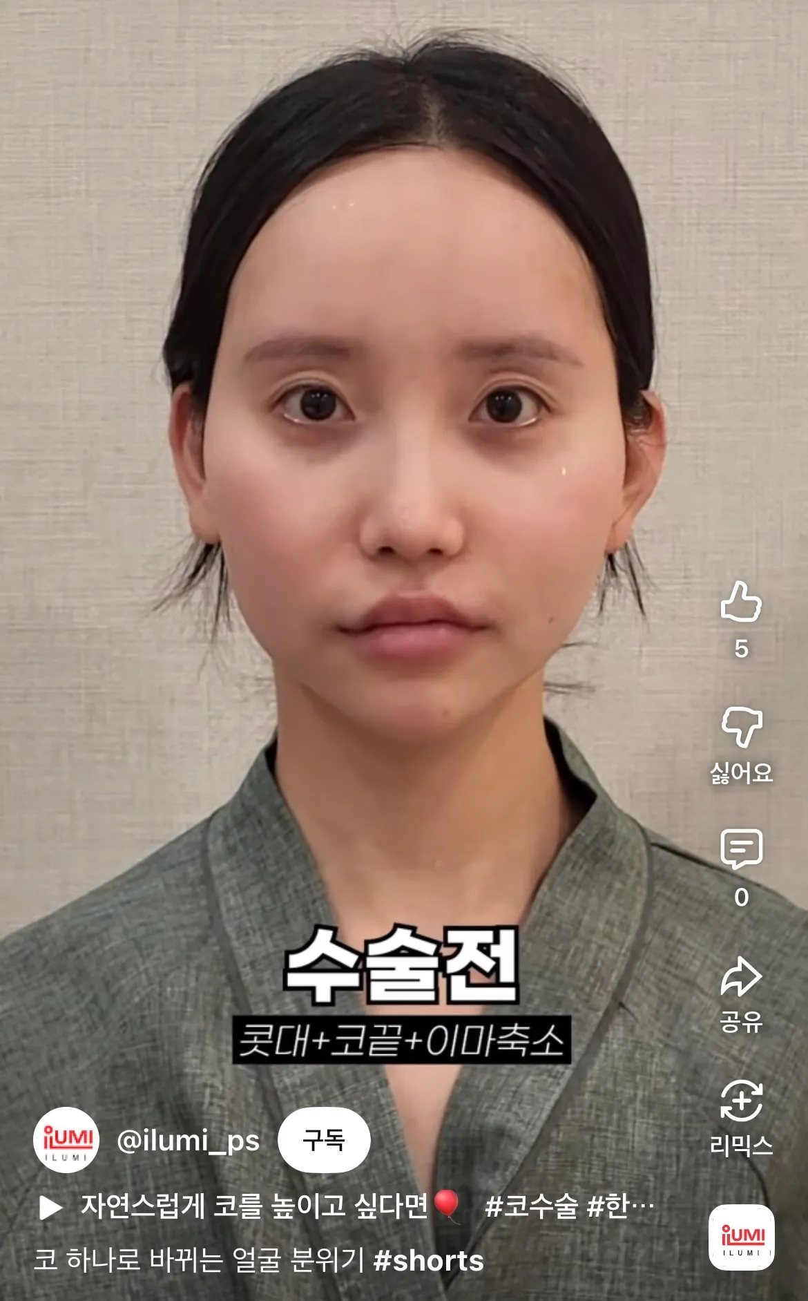 나만 비포가 더 나응거같나