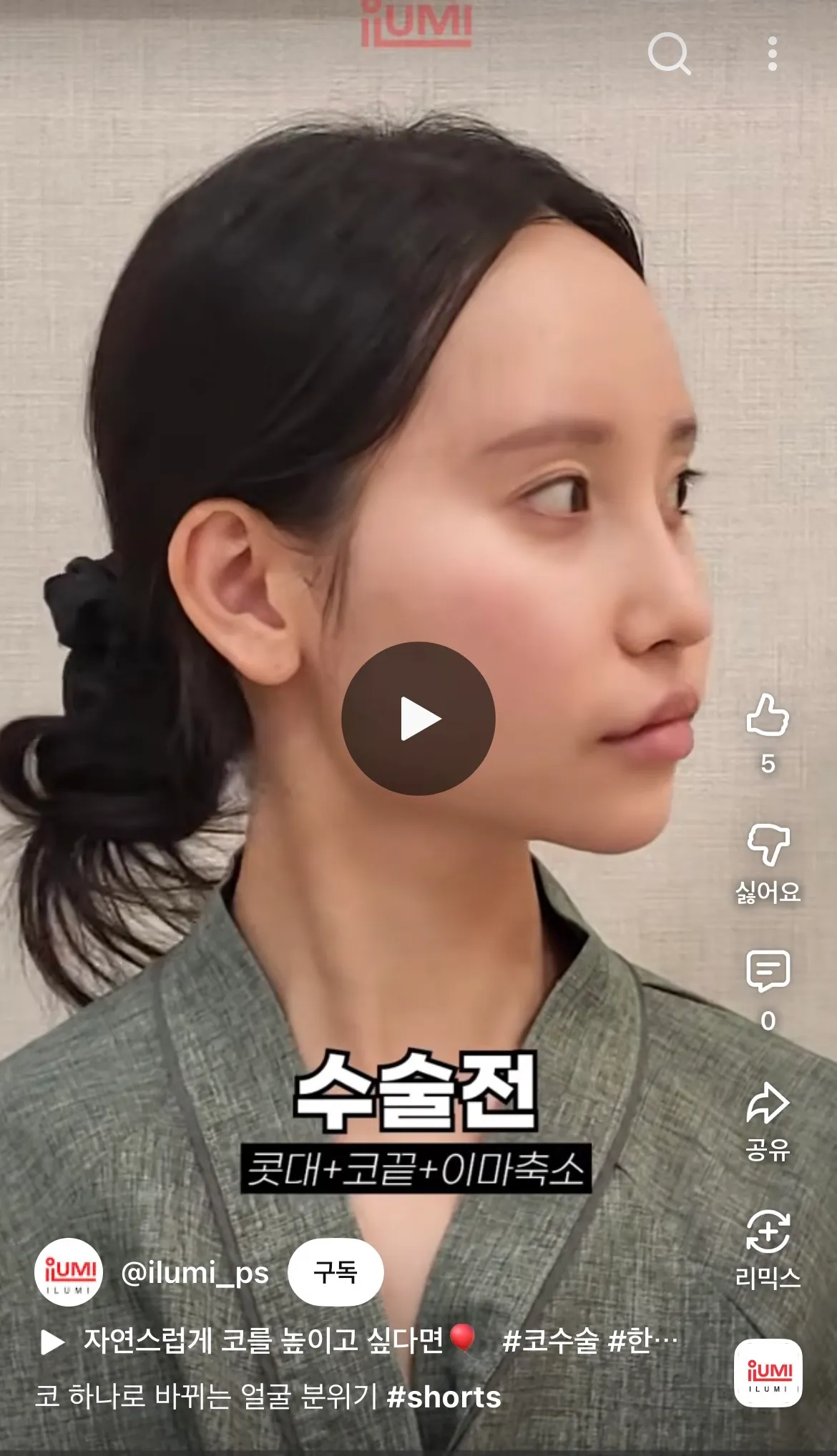 나만 비포가 더 나응거같나2