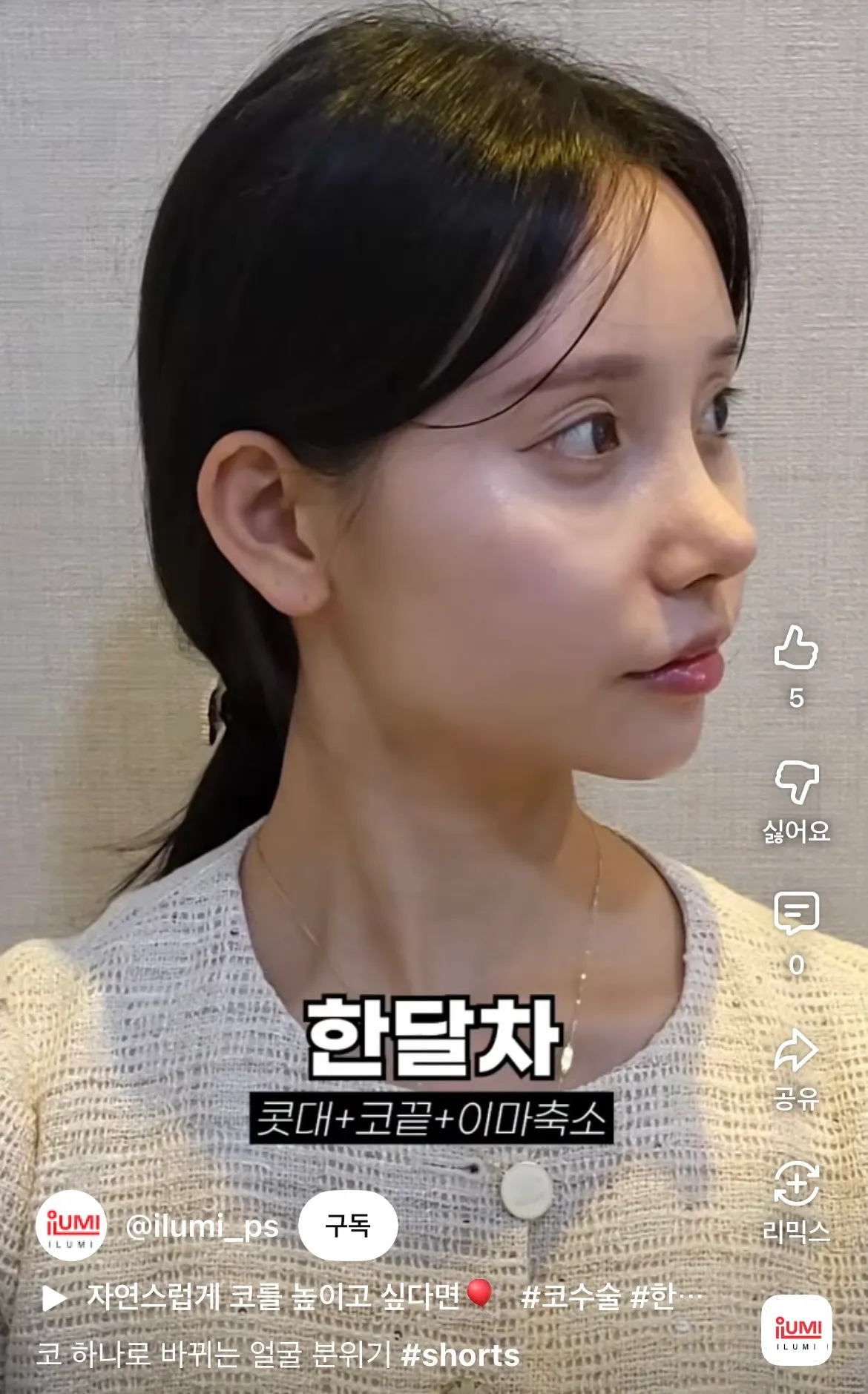 나만 비포가 더 나응거같나3
