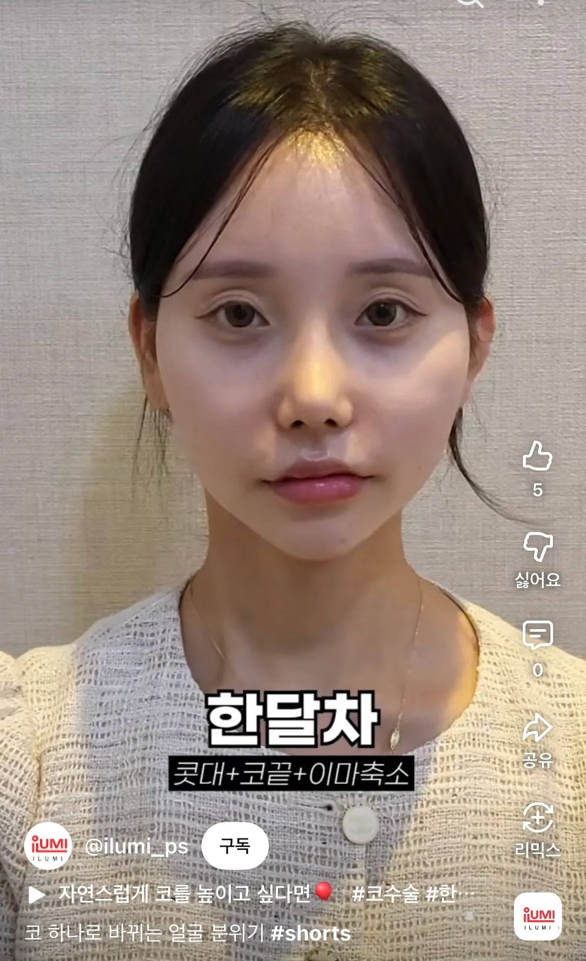 나만 비포가 더 나응거같나4