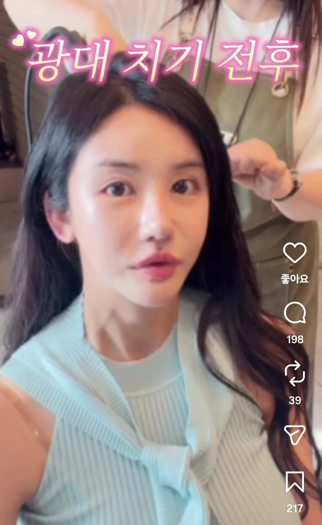 이분 광대 친게 나아요 안 친게 나아욤?2
