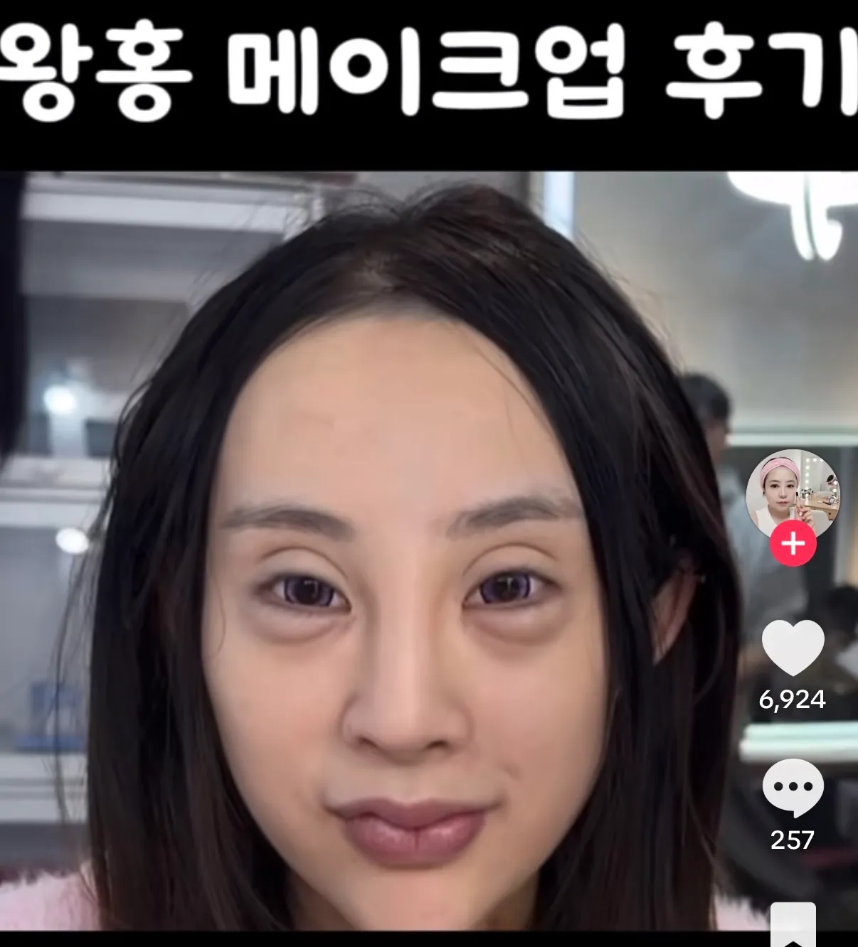 와 성형외과 어딘지알고싶다