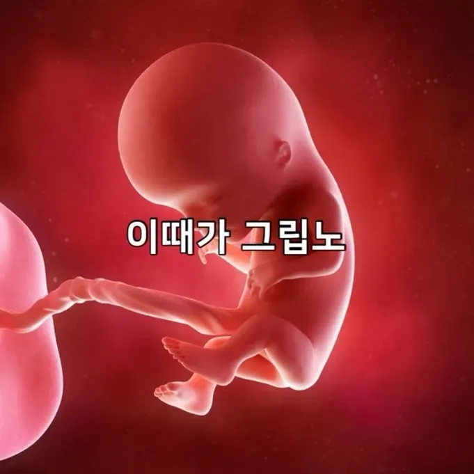 이짤 왤케웃겨
