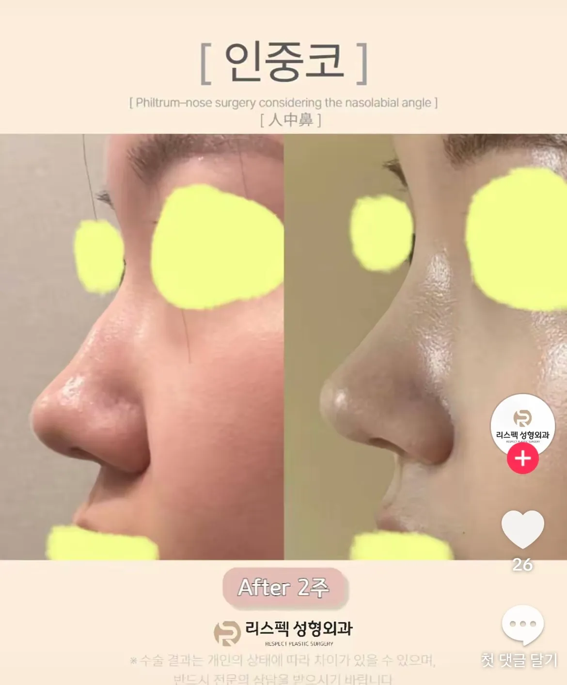음...