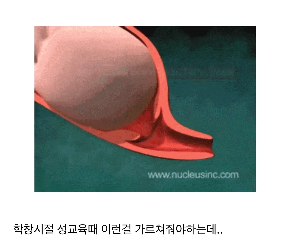 아기 출산하는 과정2
