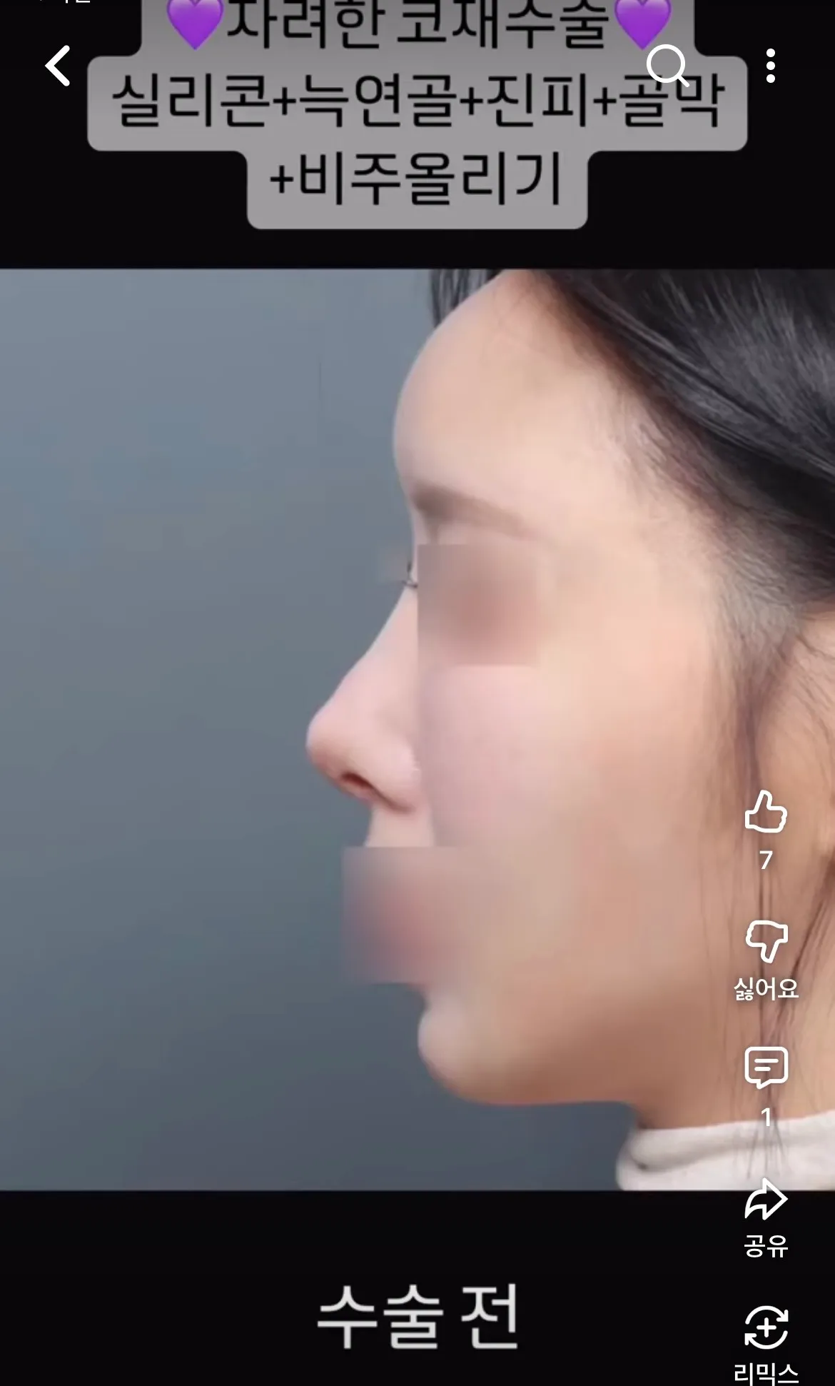 네? 아니 나 이병원 예약금걸어ㅛ는데