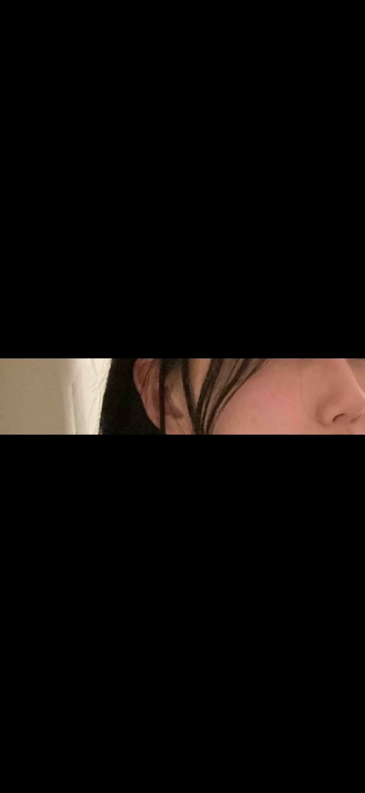 코 수술하고 대박났어효,,,2