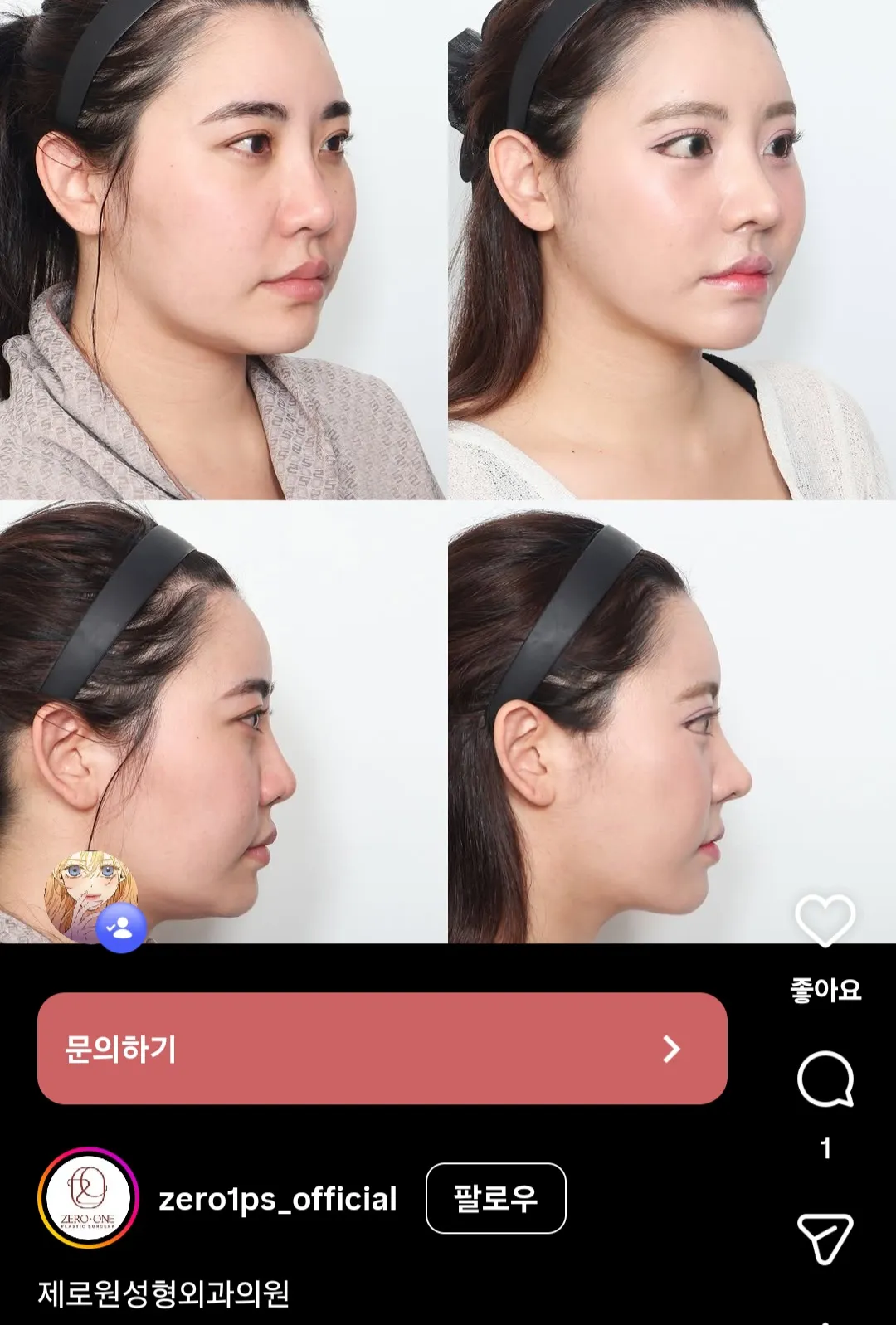 미감 괜찮은 병원인가요