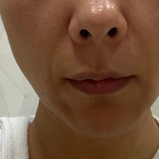 이런 주름은 뭐해야대요ㅠㅠ3