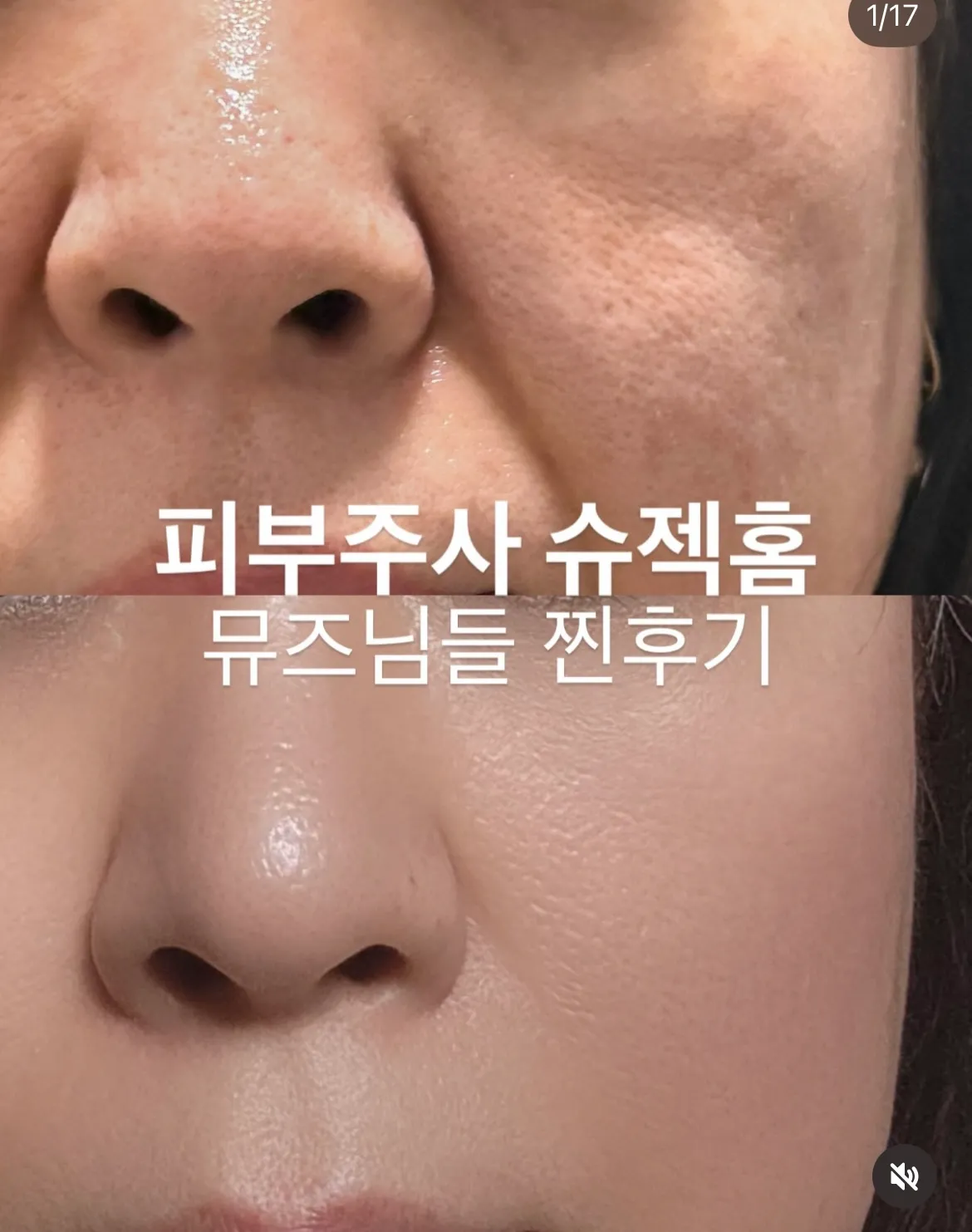 이거 찐일까여...?3