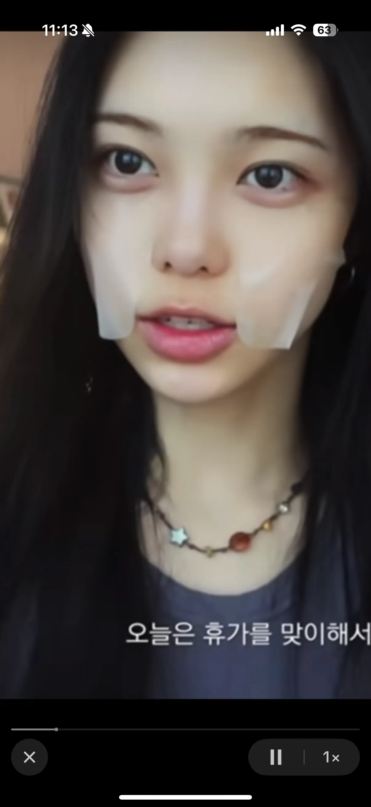 이안 애교살필러