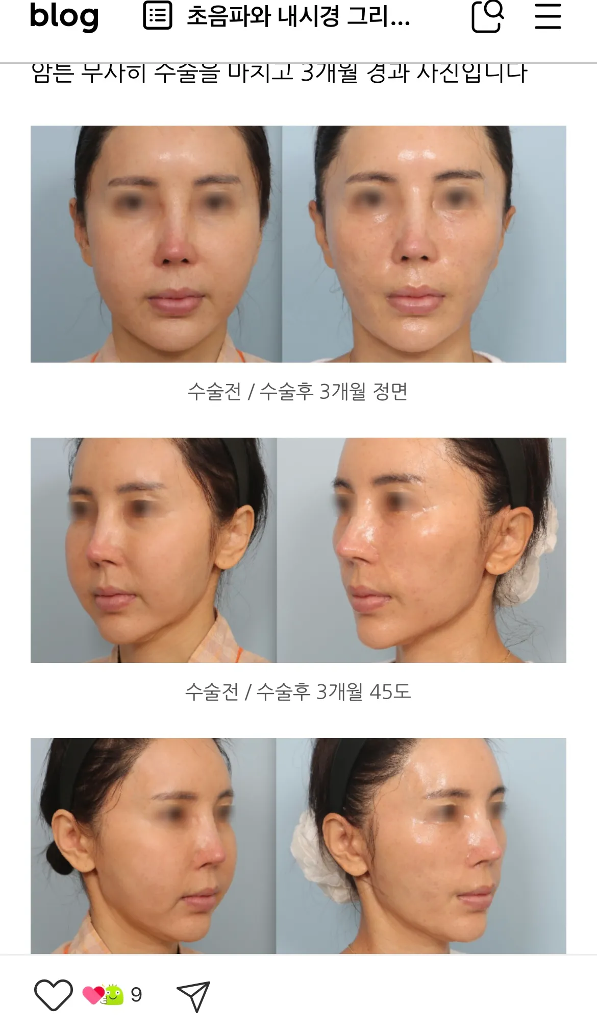 혐주의