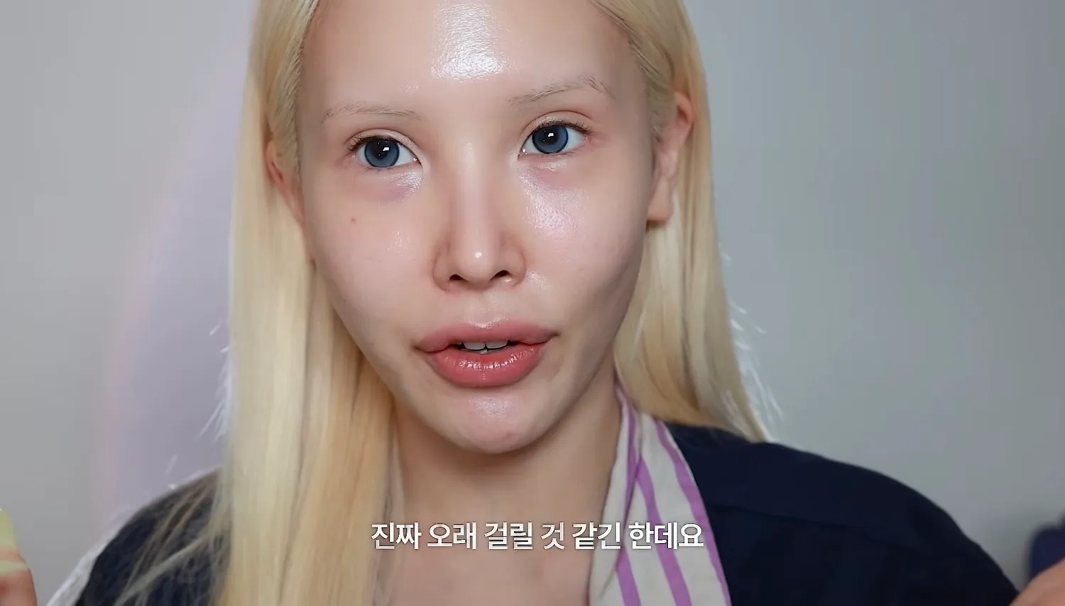 성형은 진짜 추구미랑 미감이 중요한듯요2