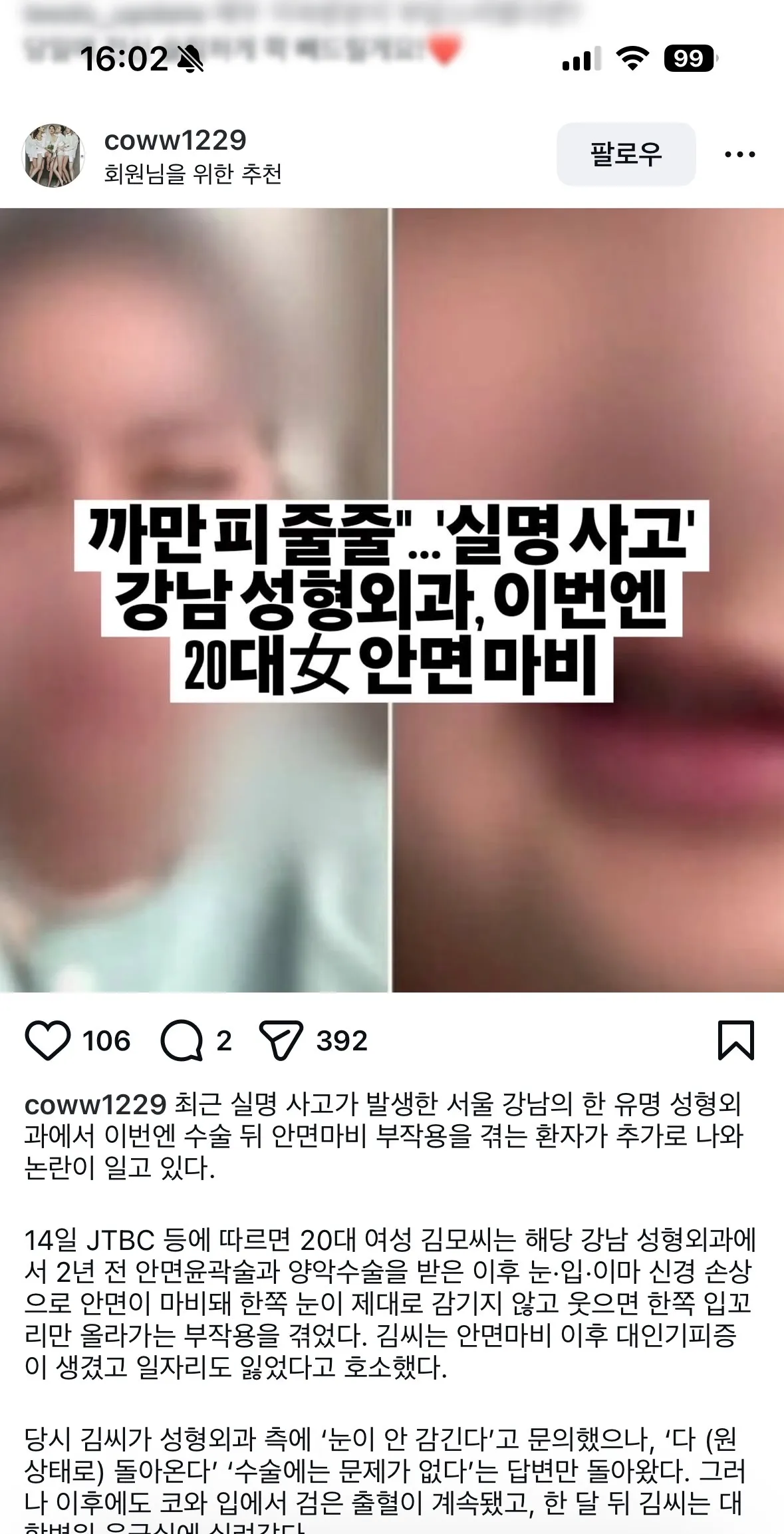 윤곽 안면마비 병원 어디에요..