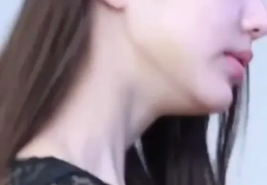 턱 왜 이러는거에요?